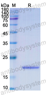 Recombinant Human MAP1B Protein, N-His