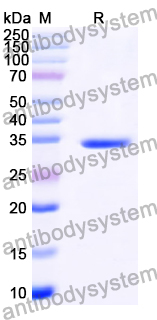 Recombinant Human GNPDA1 Protein, N-His