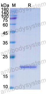 Recombinant Human YAP1 Protein, N-His