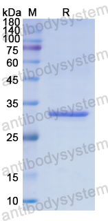 Recombinant Human UTRN Protein, N-His