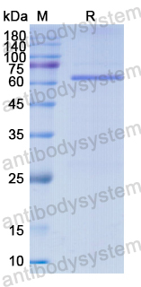 Recombinant Human GYG1 Protein, N-GST