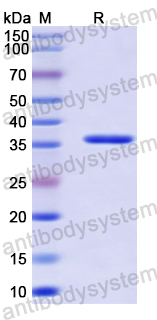 Recombinant Human GYG1 Protein, N-His-SUMO