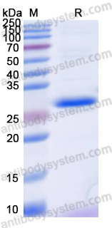 Recombinant Human CSN1S1 Protein, N-His