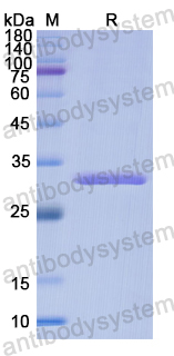 Recombinant Human NPTX2 Protein, N-His