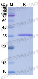 Recombinant Human XDH Protein, N-His