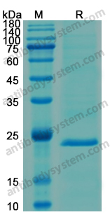 Recombinant Human CD178/FASLG/TNFSF6 Protein, N-His