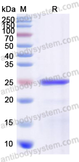 Recombinant Human ATP5PO Protein, N-His