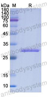 Recombinant Human LIMS1 Protein, N-His