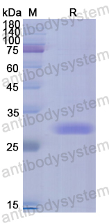 Recombinant Human IREB2 Protein, N-His