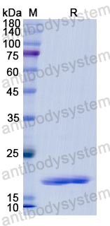 Recombinant Human REG1B Protein, N-His