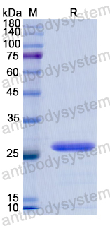 Recombinant Human TFPI2 Protein, N-His