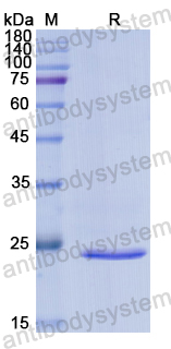 Recombinant Human SOX2 Protein, N-His