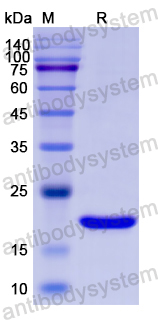 Recombinant Human SOX9 Protein, N-His