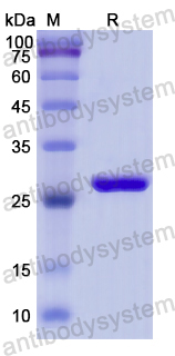 Recombinant Human GCLM Protein, N-His