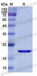 Recombinant Human CD151 Protein, N-His