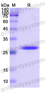 Recombinant Human IFNAR2 Protein, N-His