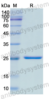 Recombinant Human GSS Protein, N-His