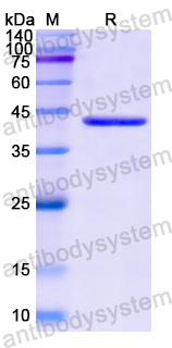 Recombinant Human NMU Protein, N-GST