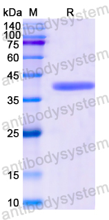 Recombinant Human KRT6C Protein, N-His