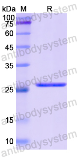 Recombinant Human NES Protein, N-His