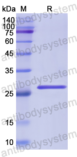 Recombinant Human CSNK1A1 Protein, N-His