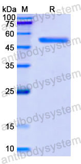 Recombinant Human CSNK1D Protein, N-His