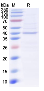 Recombinant Human TDO2 Protein, N-His