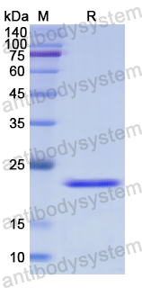 Recombinant Human TNNI2 Protein, N-His