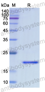 Recombinant Human CAMLG Protein, N-His