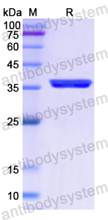 Recombinant Human NR2C2 Protein, N-His