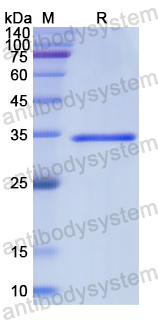 Recombinant Human LMAN1 Protein, N-His