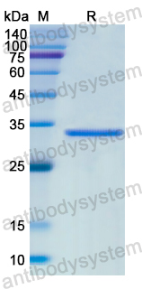 Recombinant Human FASN Protein, N-His