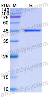 Recombinant Human CDK8 Protein, N-His