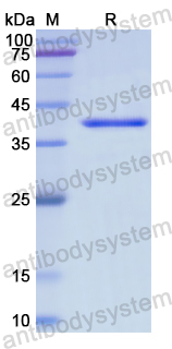 Recombinant Human FNTA Protein, N-His