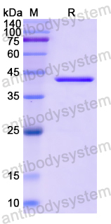 Recombinant Human DHPS Protein, N-His