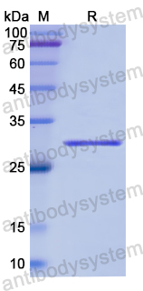 Recombinant Human ARRB1 Protein, N-His