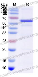 Recombinant Human ALDH7A1 Protein, N-His