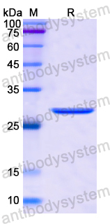 Recombinant Human CDC34 Protein, N-His