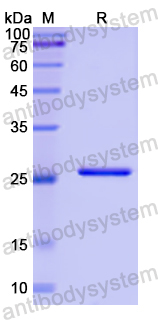 Recombinant Human CENPF Protein, N-His