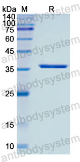 Recombinant Human SRP9 Protein, N-GST