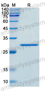 Recombinant Human DGKG Protein, N-His