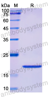 Recombinant Human CTCF Protein, N-His