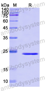 Recombinant Human CEBPD Protein, N-His