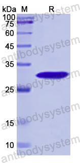 Recombinant Human MCM2 Protein, N-His