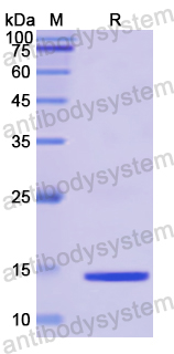 Recombinant Human COMP Protein, N-His