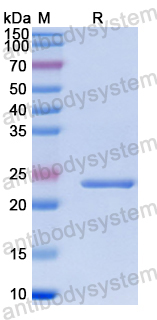 Recombinant Human TMED10 Protein, N-His-SUMO