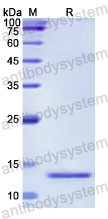 Recombinant Human NUMB Protein, N-His