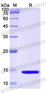 Recombinant Human PGF/PlGF Protein, N-His