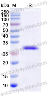 Recombinant Human VEGFB Protein, N-His