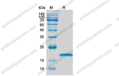 Recombinant Human VEGFB Protein, C-His